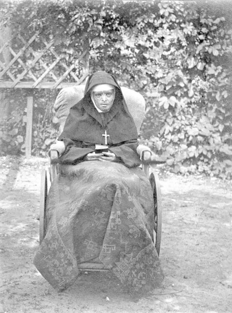 Zuster Longina verbrand in het aangezicht, 1915.